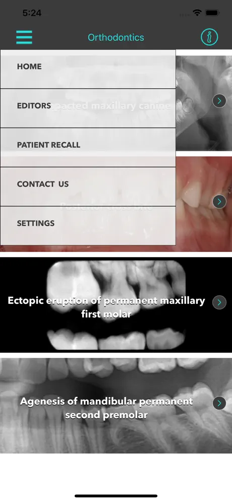 Interceptive Orthodontics