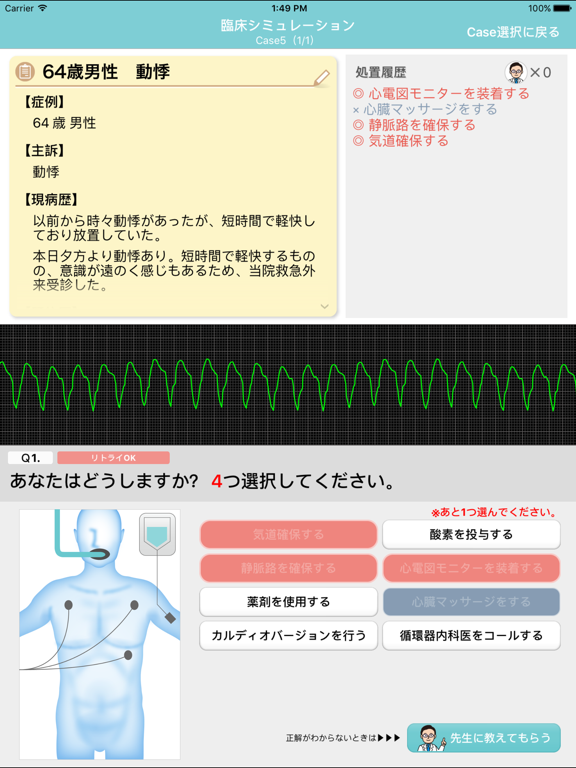 二次救命処置トレーニングアプリのおすすめ画像4