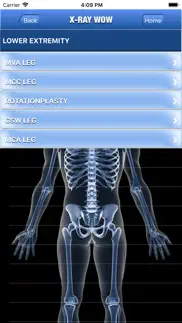 x-ray wow iphone images 3
