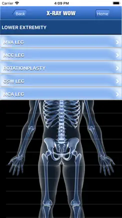 X-Ray Wow iPhone image 3