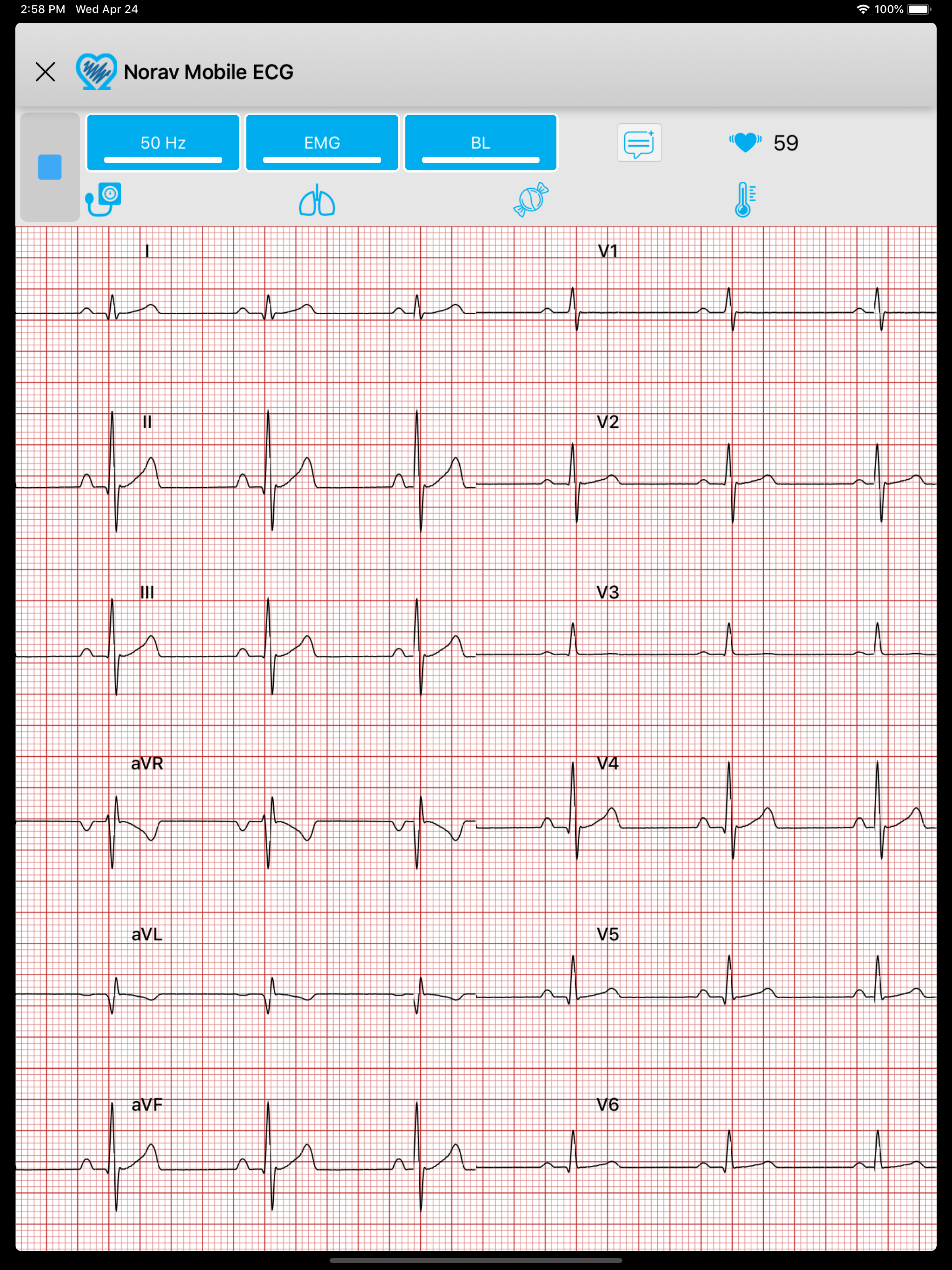 Norav Medical Mobile ECG