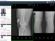 teletip ipad resimleri 3