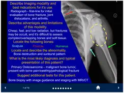 Basic Radiology - SecondLook iPad image 3