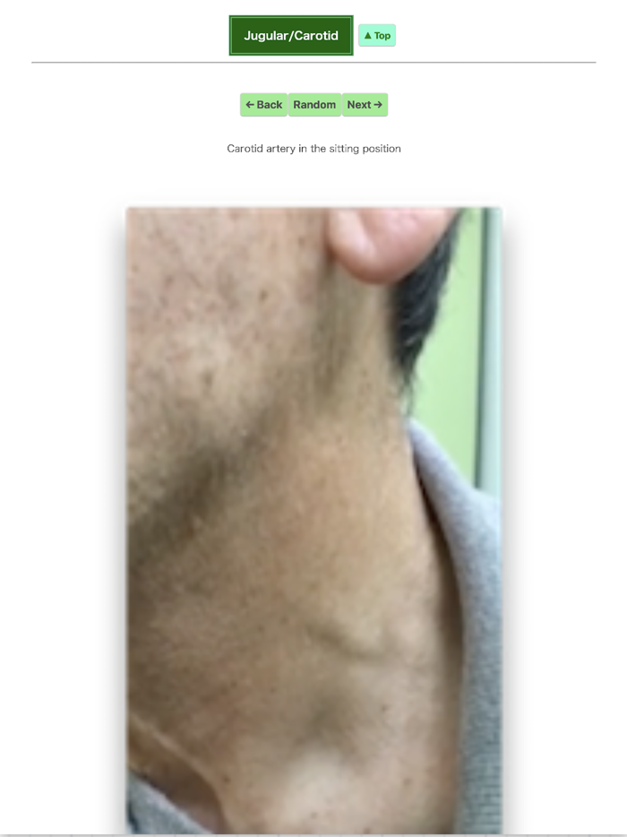 Pocket Heart Physical Exam