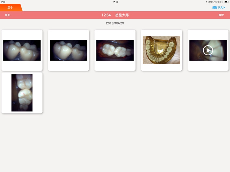 DentalShot screenshot-6