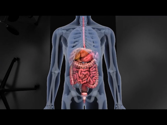 Edwards Clinical Education iPad screenshot 3 - Medical app