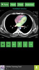 Anatomy on Radiology CT screenshot