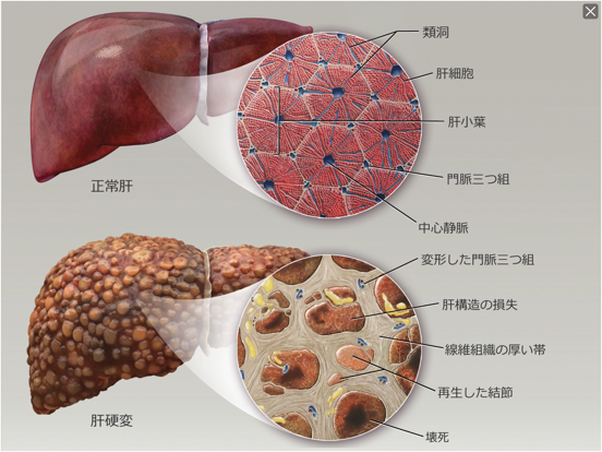 生理学と病理学のおすすめ画像10