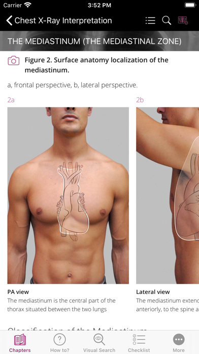 Chest X-ray Interpretation screenshot 2