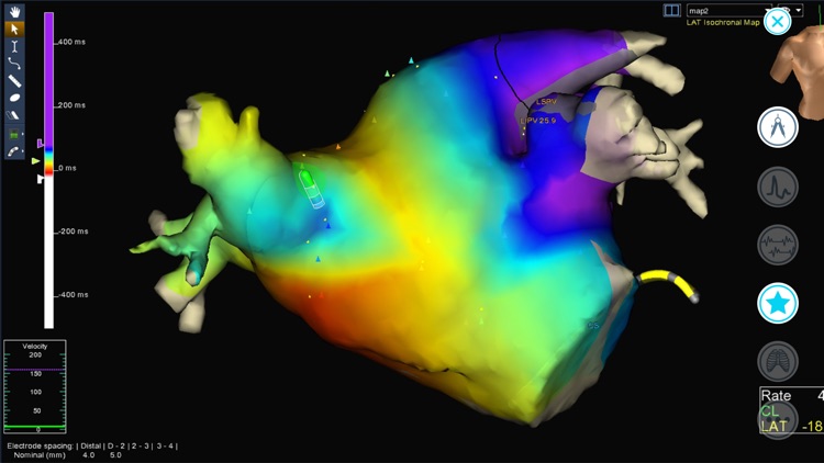 Cardiac Arrhythmia Challenge screenshot-8
