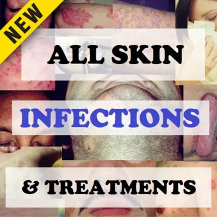 Skin Infections and Treatments Читы