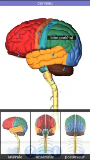 How to cancel & delete anatomie visuel 3