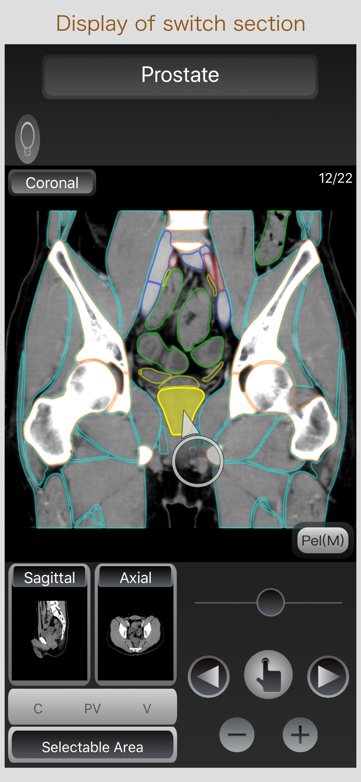 CT Passport Abdomen
