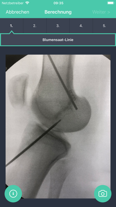 Screenshot #2 pour ACL-X