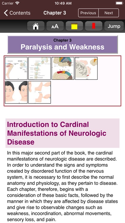 Adams & Victor's Neurology 11e screenshot-3
