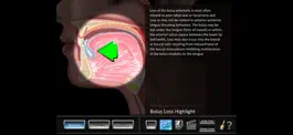Game screenshot Oral Disorders mod apk