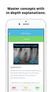 nbde 2 dental boards mastery iphone screenshot 4