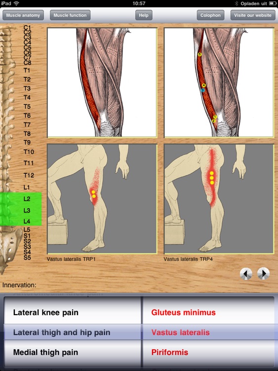 Dry Needling Pro screenshot-3