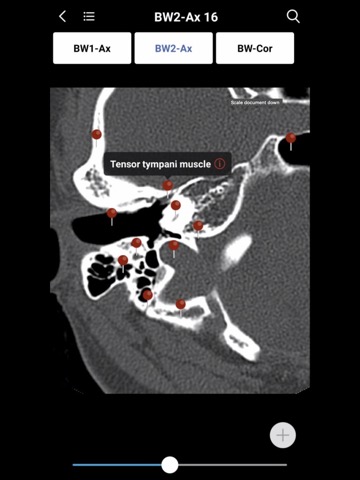 MedImaging-Radiology Made Easyのおすすめ画像5