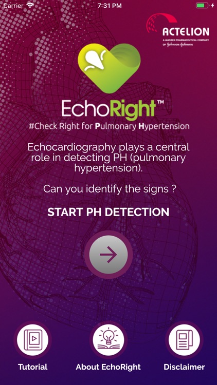 EchoRight