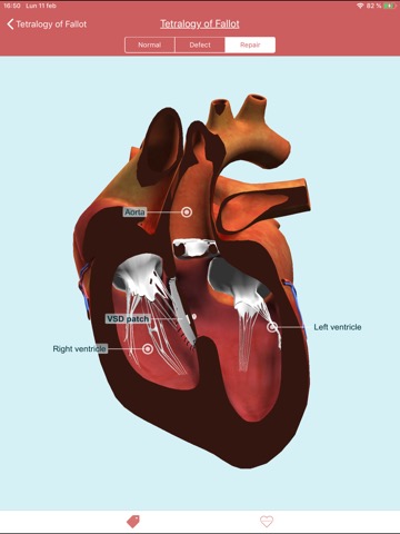 eMurmur Heartpediaのおすすめ画像5