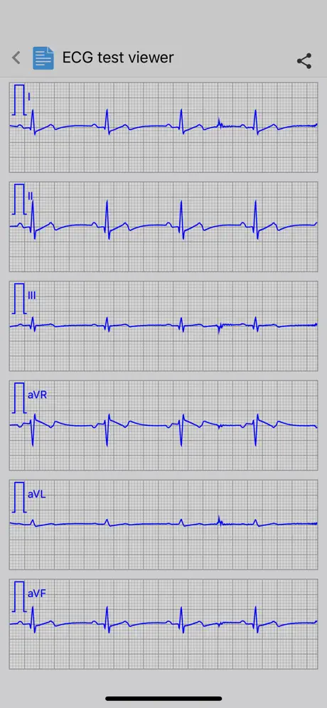Istel ECG