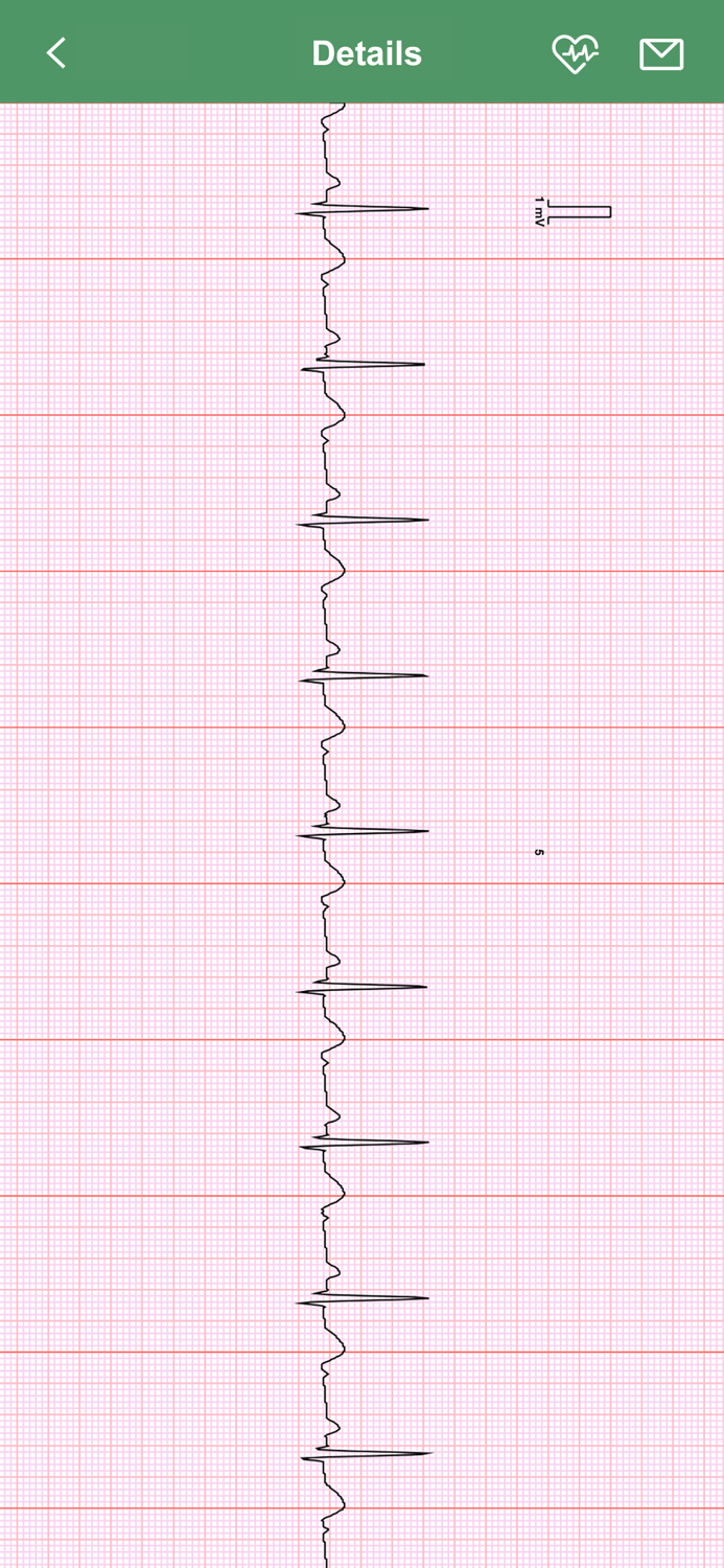 iBP ECG Pro