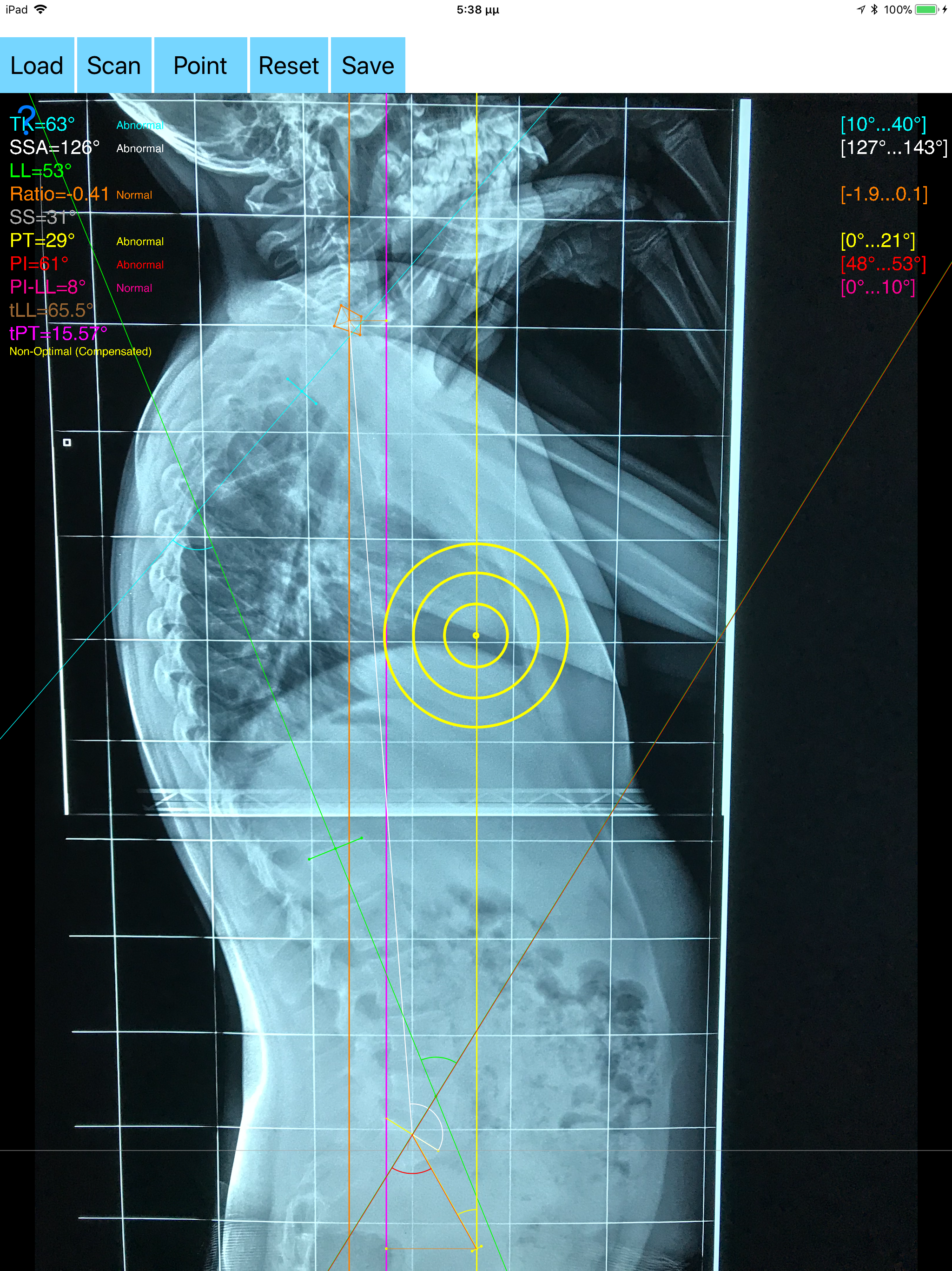 SagittalBalanceApp