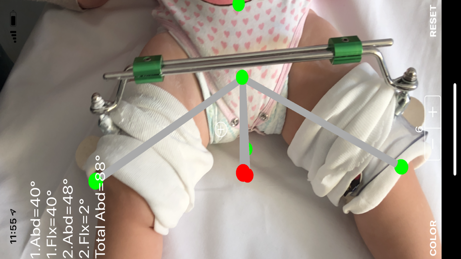 #5. HarnessARapp (iOS) 由: ORTHOPRACTIS.COM SINGLE MEMBER P.C.