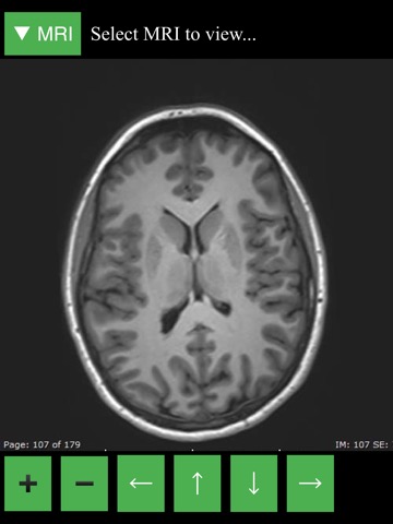MRI Viewerのおすすめ画像1