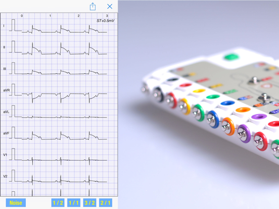 Screenshot #4 pour ECG Simulator