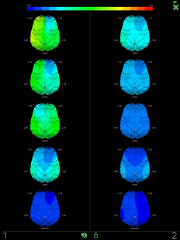 Opti Brainのおすすめ画像4