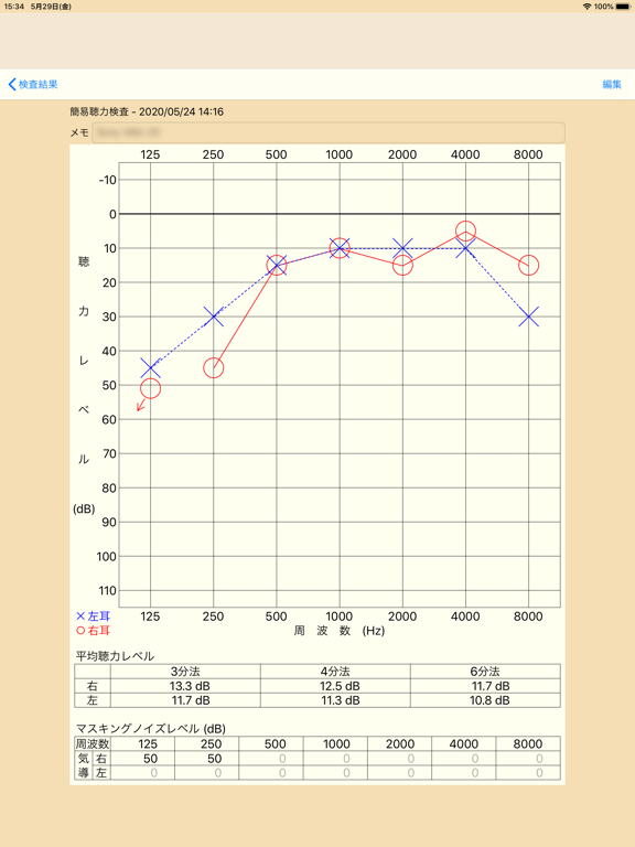 自分で聴力検査のおすすめ画像3