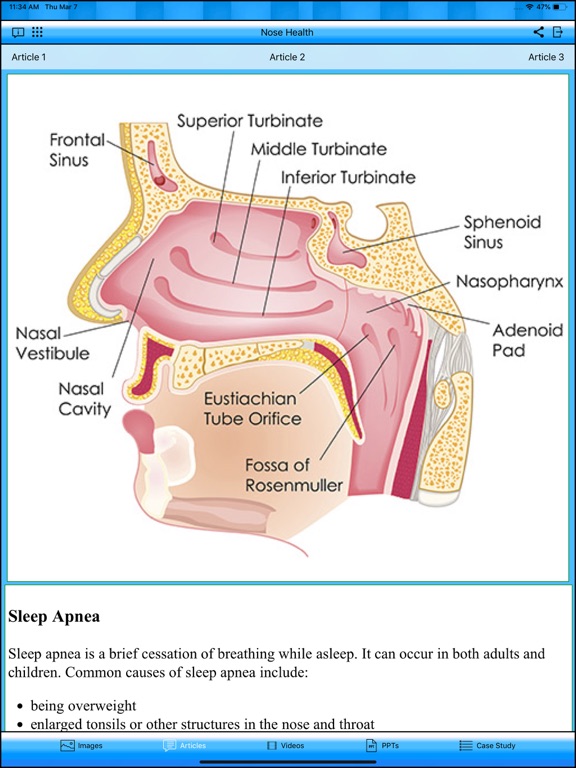 Nose Health iPad screenshot