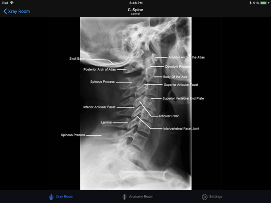Screenshot #6 pour iRad Xrays