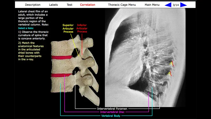 Human Skeleton: Gross Anatomy screenshot 3 of 10