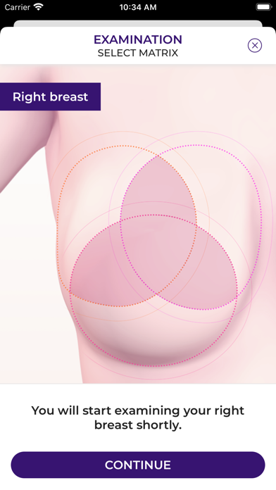 Braster Care Screenshot