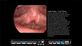 Game screenshot Vocal Pathology: Polyps apk