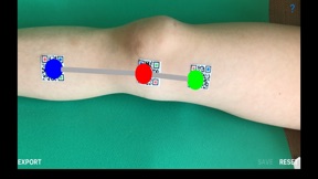 DynamicGoniometerAR screenshot