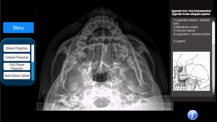 Anatomy and X-Ray Positioning screenshot-3