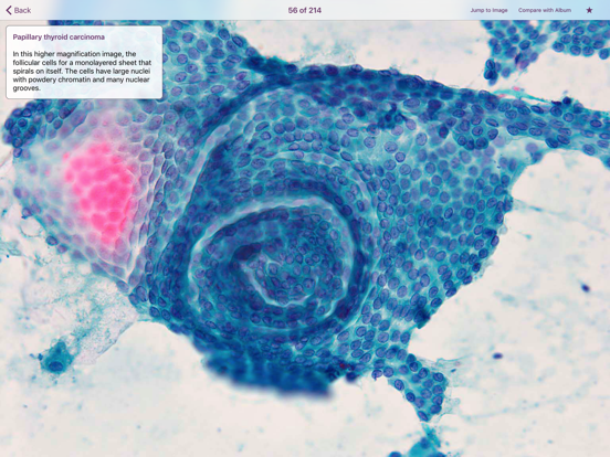 Thyroid Pathologyのおすすめ画像3