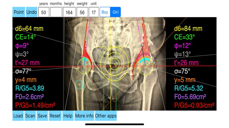 HipBiomechanicsApp screenshot-7
