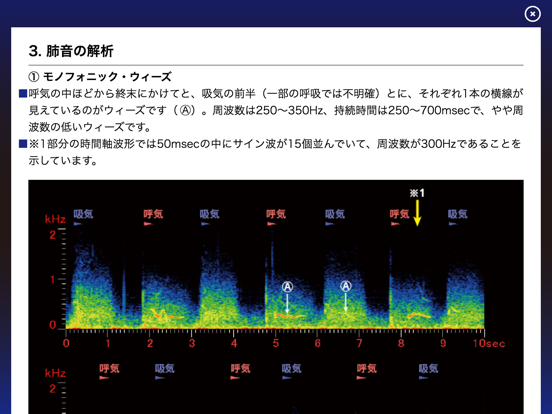 肺の聴診トレーニング - 見える肺音のおすすめ画像5