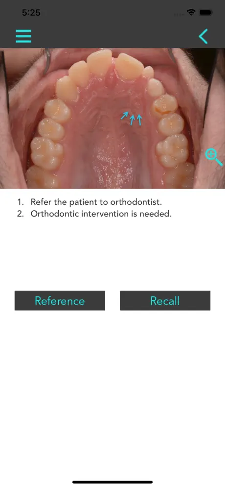 Interceptive Orthodontics