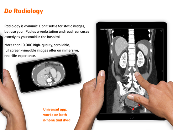 Radiology - Abdomen Dynamic iPad app afbeelding 3