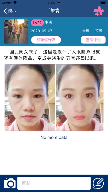 韩国id整形 - 赴韩整形美容优质选择 screenshot-3