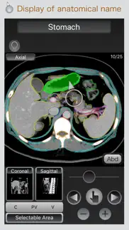 ct passport abdomen iphone screenshot 1