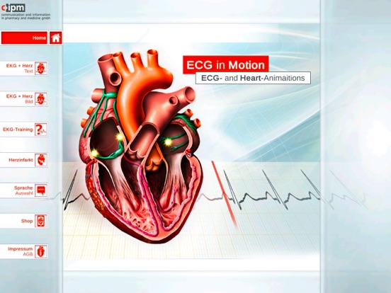 Screenshot #4 pour ECGinMotion Abo