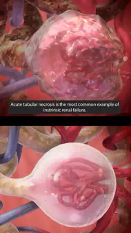 Physiology & Pathology iphone resimleri 3