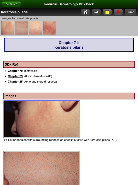 Screenshot #6 pour Pediatric Dermatology DDx Deck
